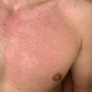 LashLuv Beauty Bar Bothell WA Male Brazilian Procedure Complete After Look Esthetician